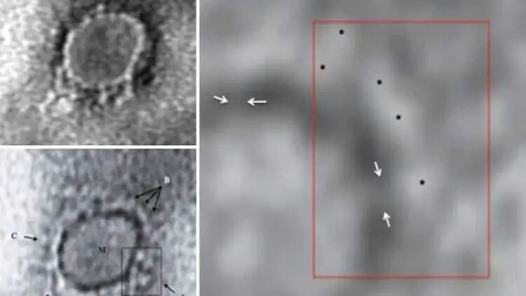 First images from India of virus causing Covid-19 captured by scientists