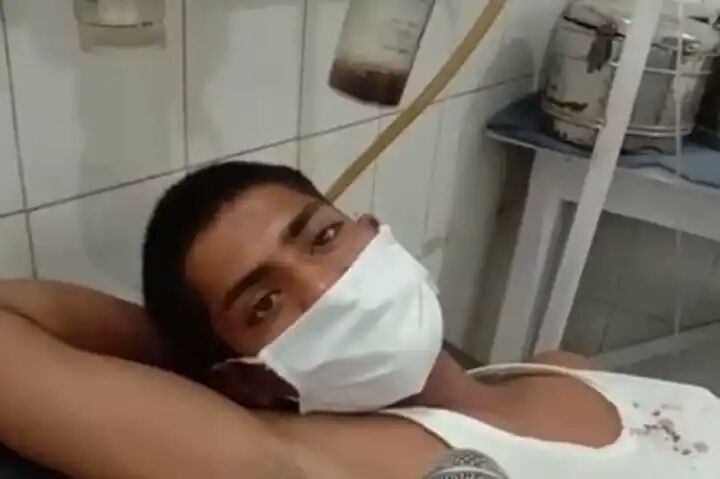 Murder Convict Chops off His Penis Inside Gwalior Jail, Offers it to 'Shivling'